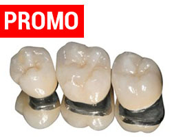liberal plug Disgraceful Protetica dentara Ploiesti | Clinica stomatologica DentessaClinica  stomatologica Dentessa
